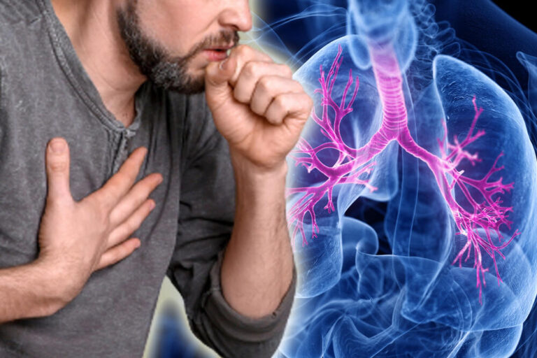 Tridemija vratila zaštitne maske, za koga su obavezne