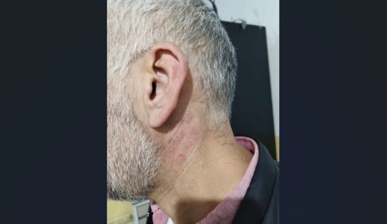 Priveden pravnik Miloš Subotić u Kosovskoj Mitrovici, optužen za vandalizam, tvrdi da je bio žrtva policijske brutalnosti